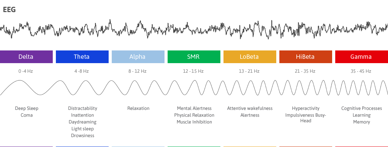 انواع امواج مغزی ( موج آلفا، تتا، بتا و گاما ) - روان مد تجهیز